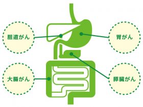 microarray-tokucyou